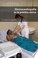 Electrocardiografía en la práctica clínica